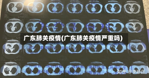 广东肺关疫情(广东肺关疫情严重吗)-第2张图片