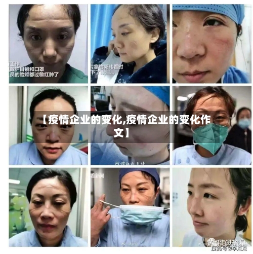【疫情企业的变化,疫情企业的变化作文】-第3张图片