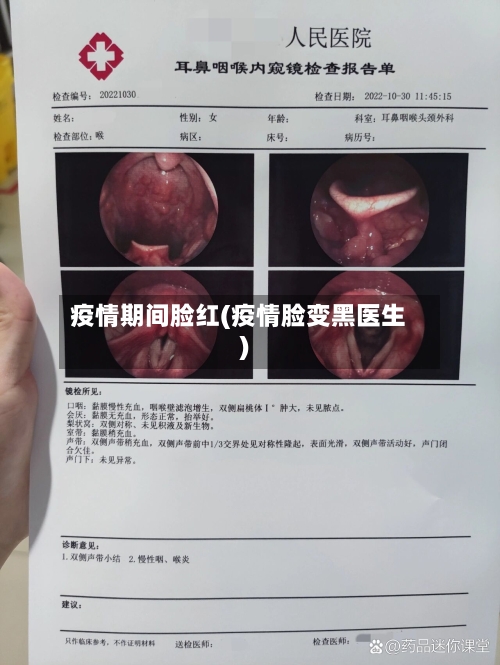 疫情期间脸红(疫情脸变黑医生)-第3张图片