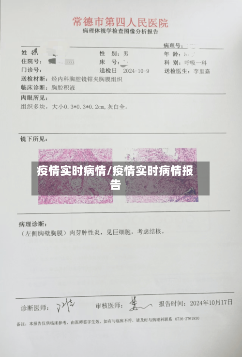 疫情实时病情/疫情实时病情报告