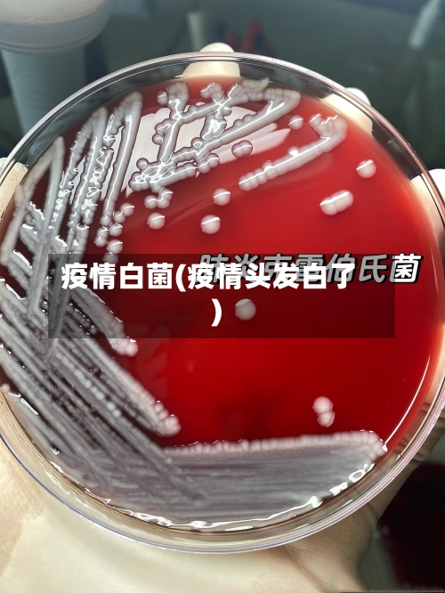 疫情白菌(疫情头发白了)-第3张图片