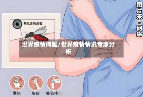 世界疫情问题/世界疫情情况专家分析